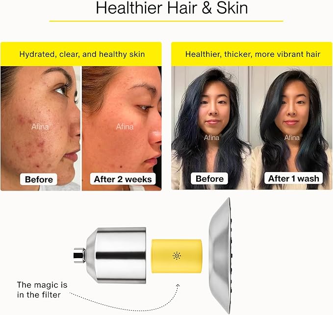 Afina Shower Head with Filter - High Pressure Filtered Shower Head - Improves Skin & Hair by Reducing Chlorine & Heavy Metals from Hard Water | Shower Filter (Nickel)