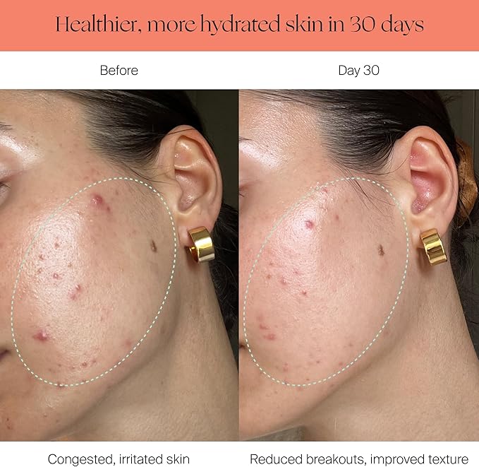 Canopy Filtered Shower Head - High Pressure Shower Head Filter for Hard Water - Shower Filter To Remove Impurities for Healthier Scalp, Skin & Hair - Support Hair Growth & Minimize Breakage - Chrome