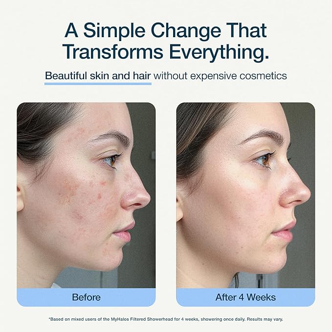 MyHalos® Filtered Shower Head for Hard Water Filter - High Pressure, Removes Chlorine - Shower Head Filter for Hard Water Softener Showerhead, Easy Install, For Hair & Skin, Filtering (Chrome)