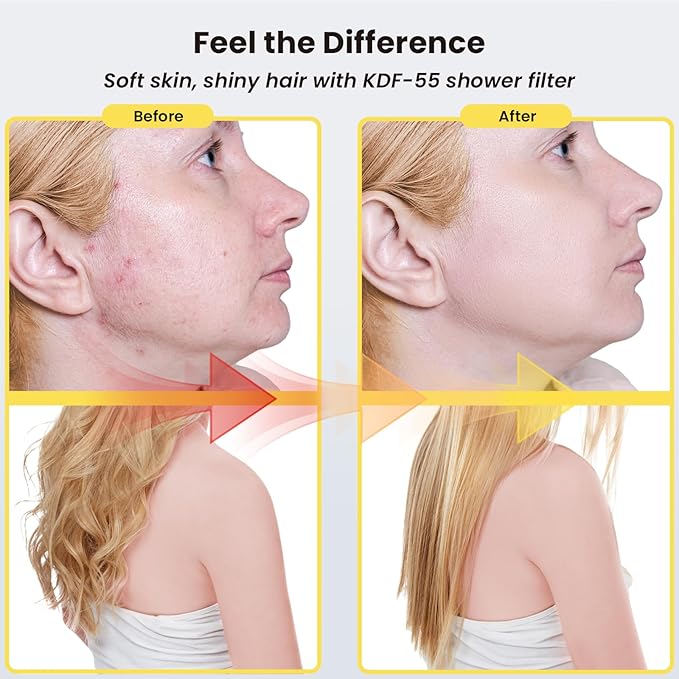 Filtered Shower head, Rain Shower Head with Filter, High Pressure Shower Filter Head for Hard Water, 99% REMOVAL for Chlorine, Heavy Metals, Improves Skin & Hair, Brushed Nickel