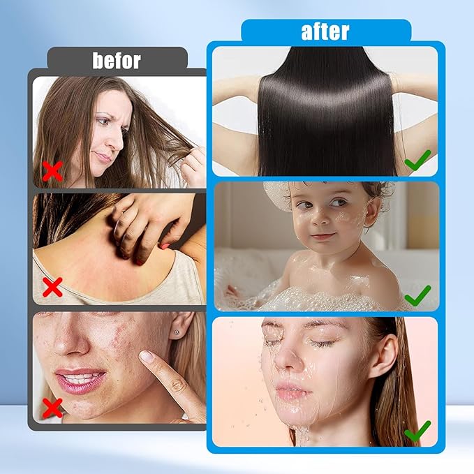 MZY LLC 4 Pack 22 Stage Shower Filter Replacement, Universal Shower Filter Removes Heavy Metals, Compatible with Similar Designs