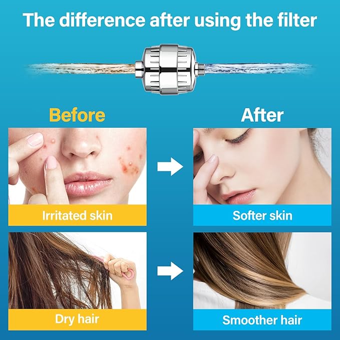 20 Stage Shower Filter With 2 Cartridges, Shower Head Filter for Hard Water, Remove 99% Chlorine, Fluoride, Heavy Metals, High Output Shower Water Filter Improves Your Skin, Hair and Nails