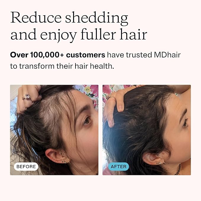 Filtered Showerhead - 20 Stage Water Filtration System for Healthier Hair & Skin, Removes Chlorine & Heavy Metals, Dermatologist Tested, Includes 2.5 & 1.8 GPM Flow Restrictors, High Pressure