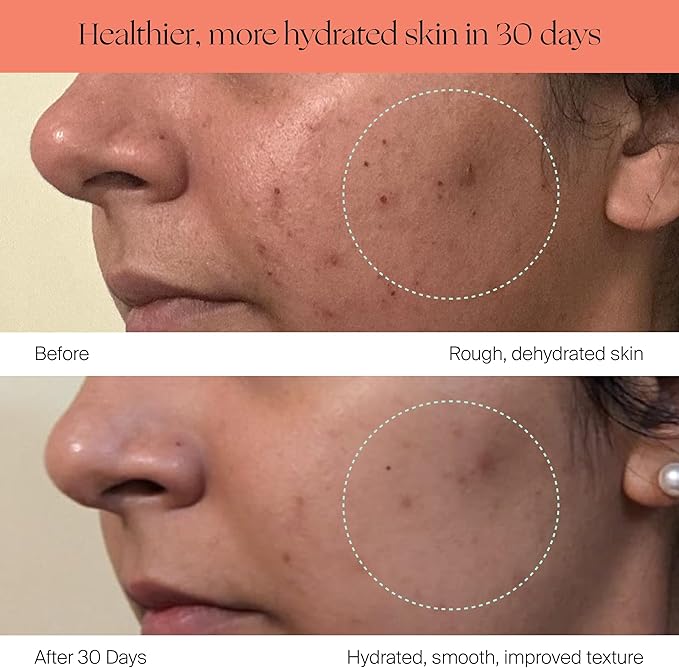 Canopy Bedside Evaporative Humidifier - 36 HR Run Time, 2.5L Capacity - No Mist - Help Alleviate Symptoms of Allergies, Flu, Cold, Dry Skin Includes Humidifier, Unwind Aroma, Filter - White