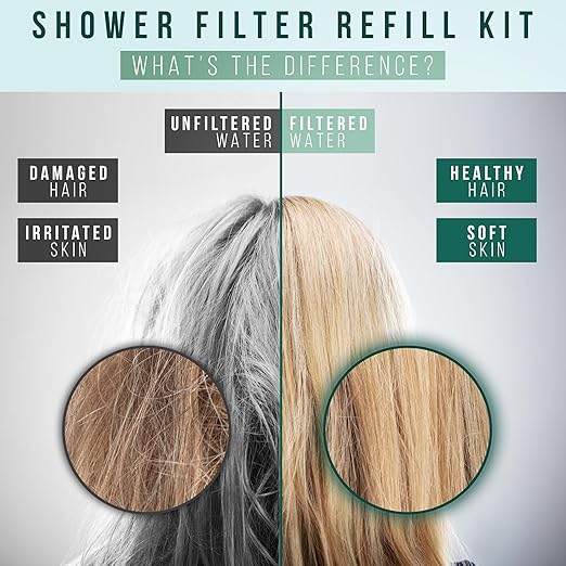Shower Filter for 100% Water Filtration - Shower Head Filter Softens Hard Water, Removes Chlorine, Toxins, and Heavy Metals for Healthier Skin and Hair - Shower Water Filter by Winthorpe