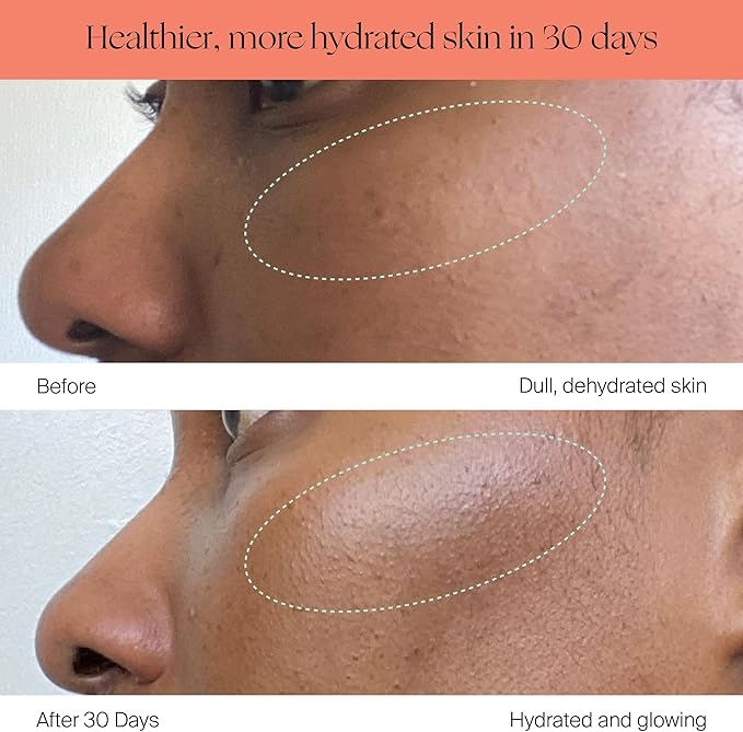 Canopy Bedside Evaporative Humidifier - 36 HR Run Time, 2.5L Capacity - No Mist - Help Alleviate Symptoms of Allergies, Flu, Cold, Dry Skin Includes Humidifier, Unwind Aroma, Filter - White