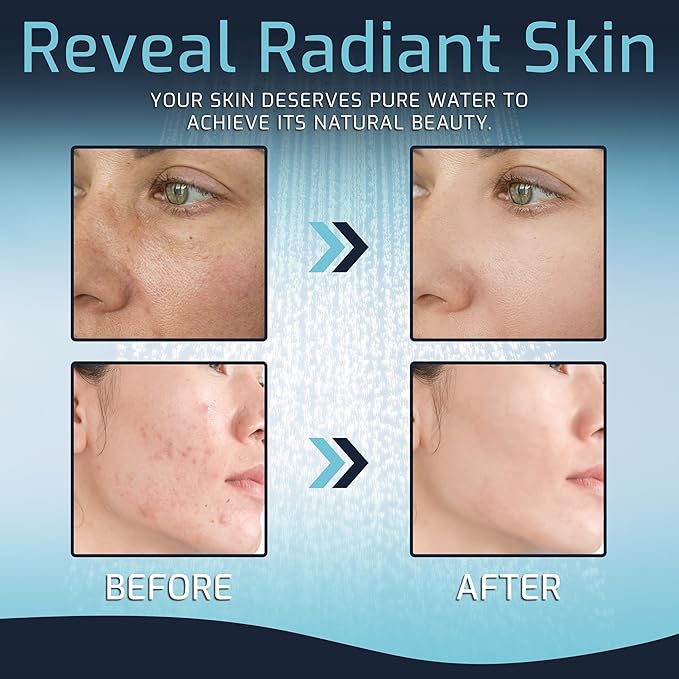 Mist Filtered Shower Head, Revitalizing 15 stage Shower Filter Combo, Improves The Condition of Your Skin & Hair, Shower Water Softener with High Output, Chrome - Shower filter for Hard Water