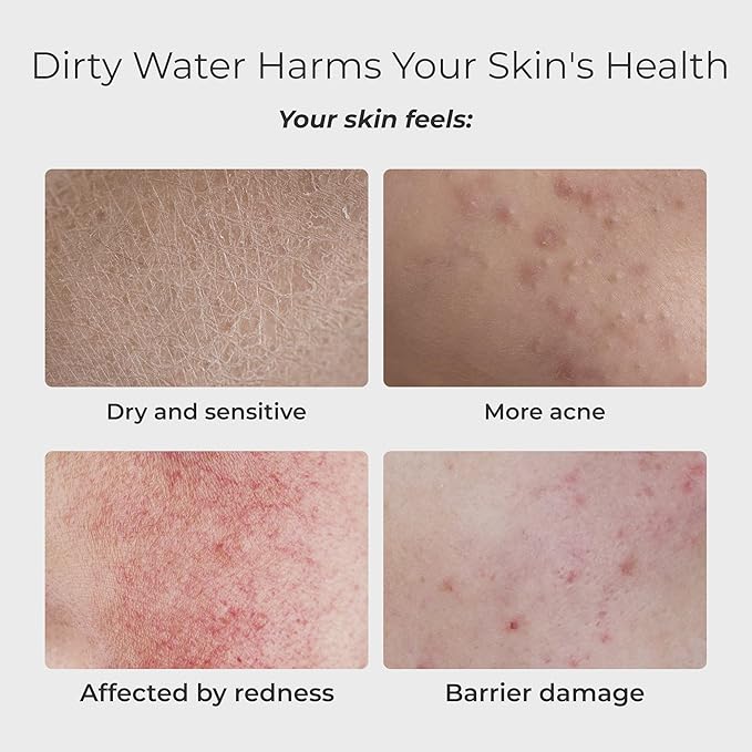 Waterdrop BFC3-Lite Skincare Face Washer Water Filter, Bathroom Sink Filter Water Faucet for Skin, Reduce 99% Chlorine, Nanoscale Deep Cleaning, Hydrate Deeply