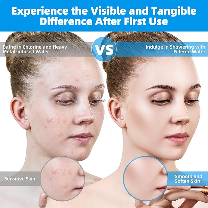 Hibbent 2 Pack Shower Filter Replacement Cartridges for Hard Water, High Output 20 Stage Shower Filter with Vitamin C to Remove Chlorine & Fluoride, Glowing Skin, Strong Nails & Shimmering Hair