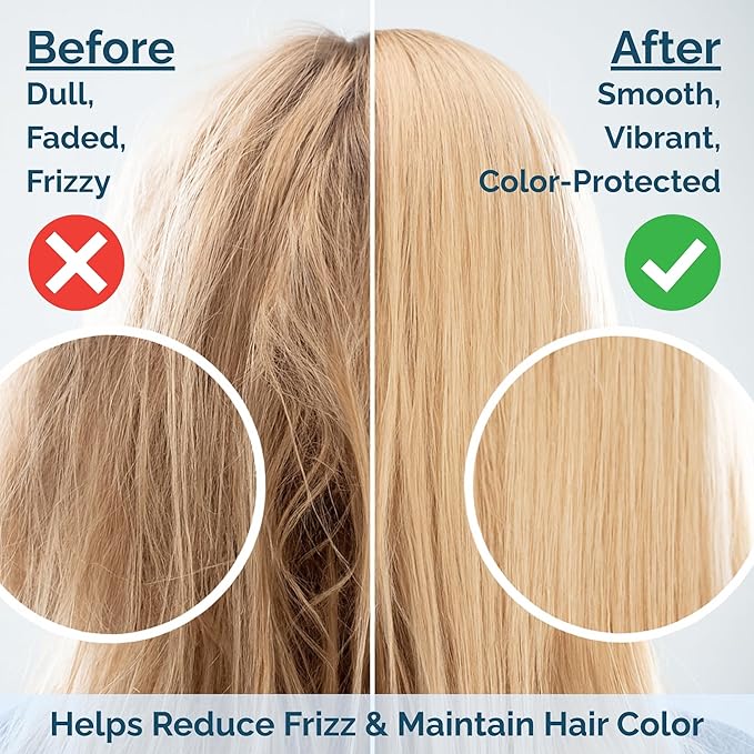 Shower Filter for Hard Water – Reduces Impurities That Cause Dry Skin, Itchy Scalp & Dull Hair – Easy Install – Universal Fit – Works with Standard Wall & Handheld Showers