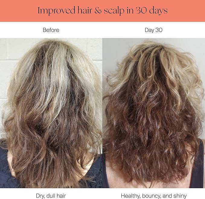 Canopy Filtered Shower Head - High Pressure Shower Head Filter for Hard Water - Shower Filter To Remove Impurities for Healthier Scalp, Skin & Hair - Support Hair Growth & Minimize Breakage - Chrome