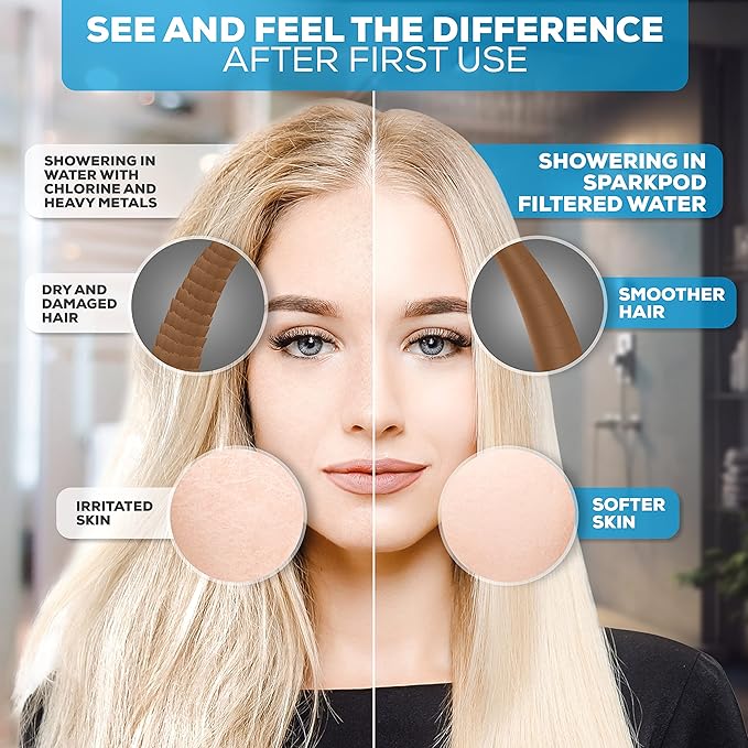 SparkPod 6" High Pressure Rain Shower Head with 23 Stage Filter Capsule & 11 Inch Adjustable Shower Arm Extension - Shower Filter Reduces Chlorine for Smoother Hair & Skin (Round, Oil-Rubbed Bronze)